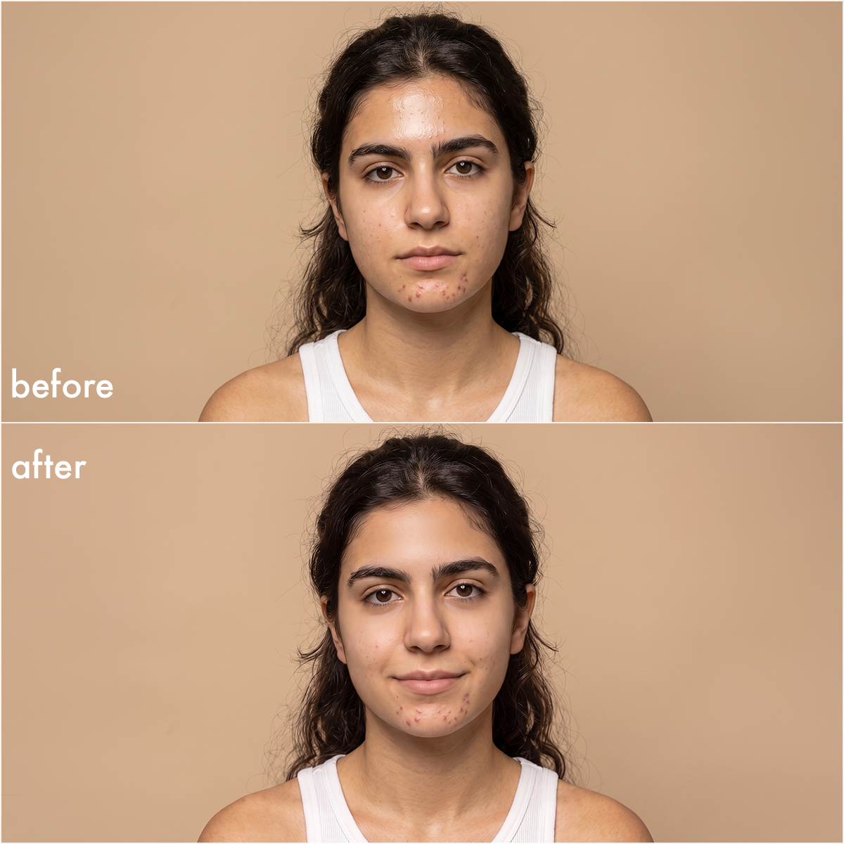pdp:6 Young Face Wipes — before & after