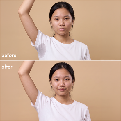 pdp:6 Young Deo Wipes — before & after