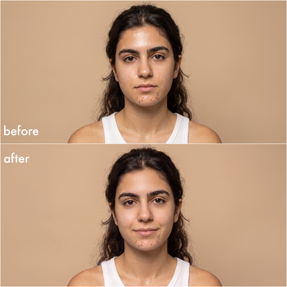 pdp:6 Young Face Wipes — before & after